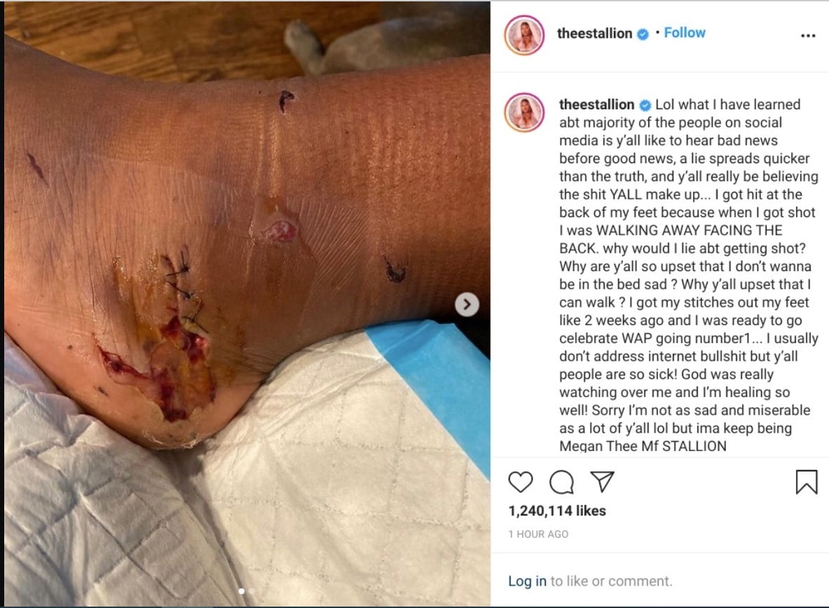 An image Megan Thee Stallion shows her graphic photos of gun shot wound