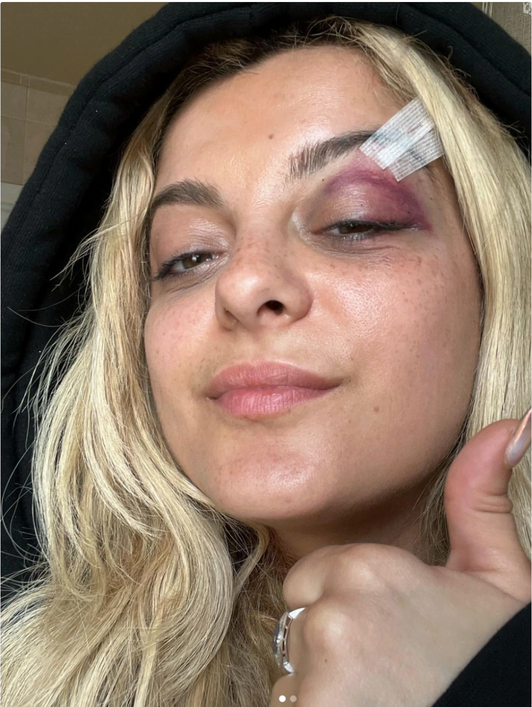Bebe Rexha Hit With Phone
