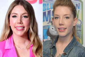 An image of Katherine Ryan before and after plastic surgery